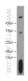 11038-1-AP - Tropomyosin-2 (TPM2)