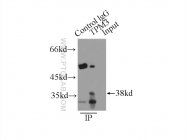10737-1-AP - Tropomyosin-3 (TPM3)