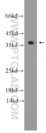 10737-1-AP - Tropomyosin-3 (TPM3)