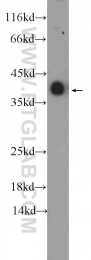 10737-1-AP - Tropomyosin-3 (TPM3)