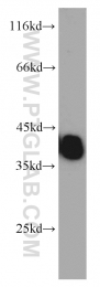 10737-1-AP - Tropomyosin-3 (TPM3)