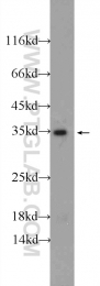 10737-1-AP - Tropomyosin-3 (TPM3)