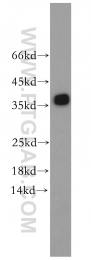 10737-1-AP - Tropomyosin-3 (TPM3)