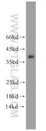 10737-1-AP - Tropomyosin-3 (TPM3)