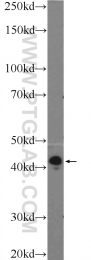 55444-1-AP - Tropomyosin-3 (TPM3)