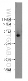 12479-1-AP - Tripeptidyl-peptidase 1 (TPP1)
