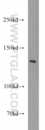 14120-1-AP - Tripeptidyl-peptidase 2 (TPP2)
