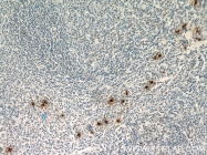 13343-1-AP - Tryptase beta-1 (TPSAB1)