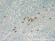66174-1-Ig - Tryptase beta-1 (TPSAB1)
