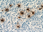 66174-1-Ig - Tryptase beta-1 (TPSAB1)