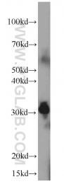 66174-1-Ig - Tryptase beta-1 (TPSAB1)
