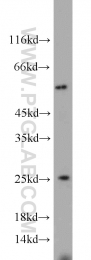 10824-1-AP - TPT1 / TCTP