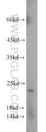 10824-1-AP - TPT1 / TCTP