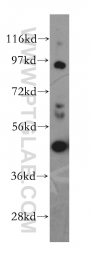 11543-1-AP - TRAF1 / EBI6