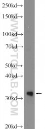 24876-1-AP - TREX1