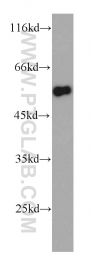 10851-1-AP - TRIM11 / RNF92