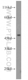 15742-1-AP - TRIM14