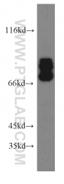 20356-1-AP - TRIM2 / RNF86