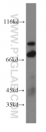 20356-1-AP - TRIM2 / RNF86