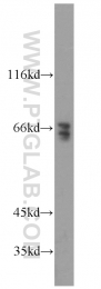 10326-1-AP - TRIM32 / HT2A