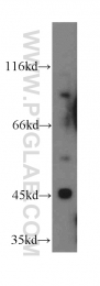 12757-1-AP - TRIM39 / RNF23