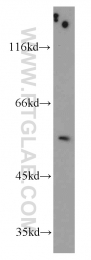 11511-1-AP - TRIM44 / DIPB