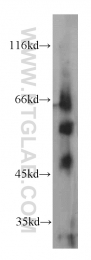 21026-1-AP - TRIM46 / TRIFIC