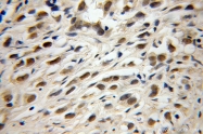 12951-1-AP - TRIM69 / RNF36