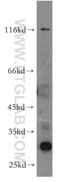 12951-1-AP - TRIM69 / RNF36