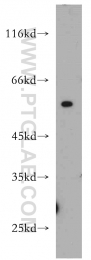 21163-1-AP - TRIP6 / OIP1