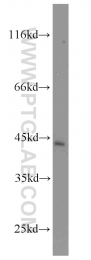 16199-1-AP - TRMT2A / HTF9C