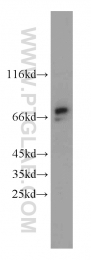 16199-1-AP - TRMT2A / HTF9C