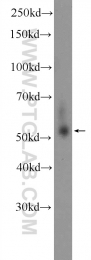 26009-1-AP - TRMT61B