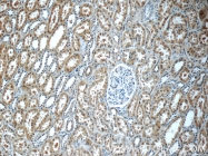 20987-1-AP - TRPV4 / Vanilloid receptor-like protein 2
