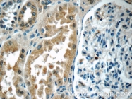 20987-1-AP - TRPV4 / Vanilloid receptor-like protein 2
