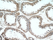 20987-1-AP - TRPV4 / Vanilloid receptor-like protein 2