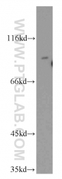 20987-1-AP - TRPV4 / Vanilloid receptor-like protein 2