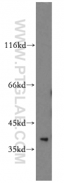 12520-1-AP - TRUB1