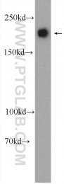 24601-1-AP - Tuberin / TSC2