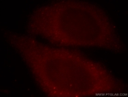 20004-1-AP - Tuberin / TSC2