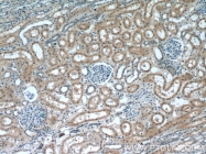20004-1-AP - Tuberin / TSC2