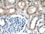 20004-1-AP - Tuberin / TSC2