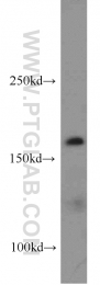 20004-1-AP - Tuberin / TSC2