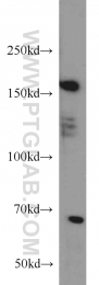 20004-1-AP - Tuberin / TSC2
