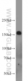 20004-1-AP - Tuberin / TSC2