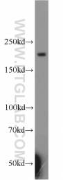 20004-1-AP - Tuberin / TSC2