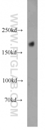 20004-1-AP - Tuberin / TSC2