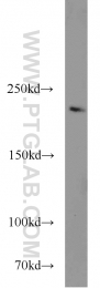 20004-1-AP - Tuberin / TSC2