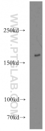 20004-1-AP - Tuberin / TSC2