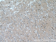 10214-1-Ig - TSC22D1